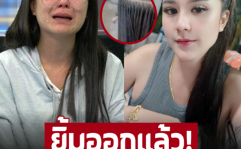 ‘สาวผมร่วง’ คนดังจาก โหนกระแส ประเด็น ต่อผมแล้วผมร่วง หัวล้าน ล่าสุดยิ้มออก ได้ต่อผมใหม่แล้ว พร้อมลั่น ความจริงก็คือความจริง